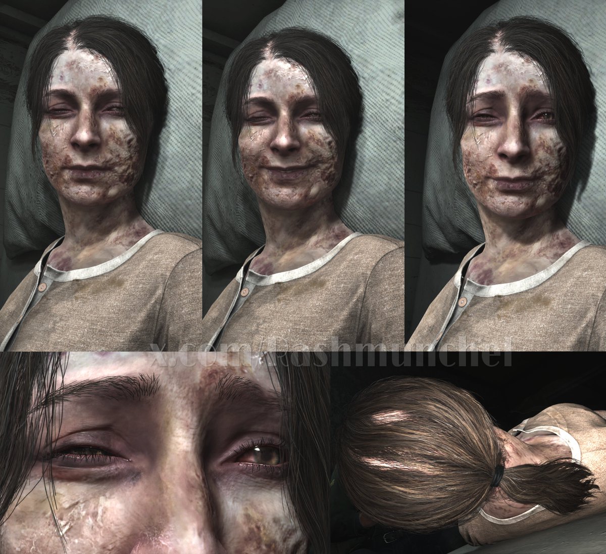 Rashmunchel's tweet image. A closer look at Mary's bedridden model. She tried to cover her bald spot by tying her hair into a ponytail. 💔
#silenthill #silenthill2 #silenthill2remake