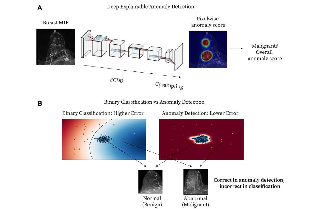 AuntMinnie's tweet image. Explainable AI model finds breast tumors on MRI #radiology #MRI #AI #breastcancer @UW @ands_zen buff.ly/D0xuY07