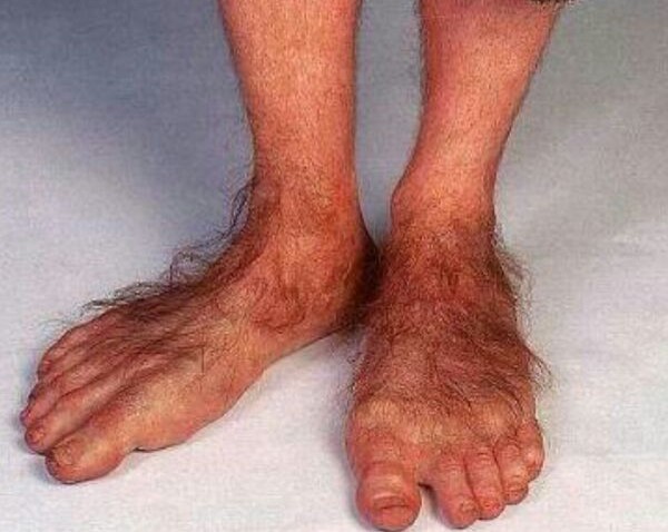 ChronicSingle's tweet image. "The new unconventional notions of beauty" A scene from   
fringepvd.org/how-much-can-y…
"#fringepvd #artsri #riarts