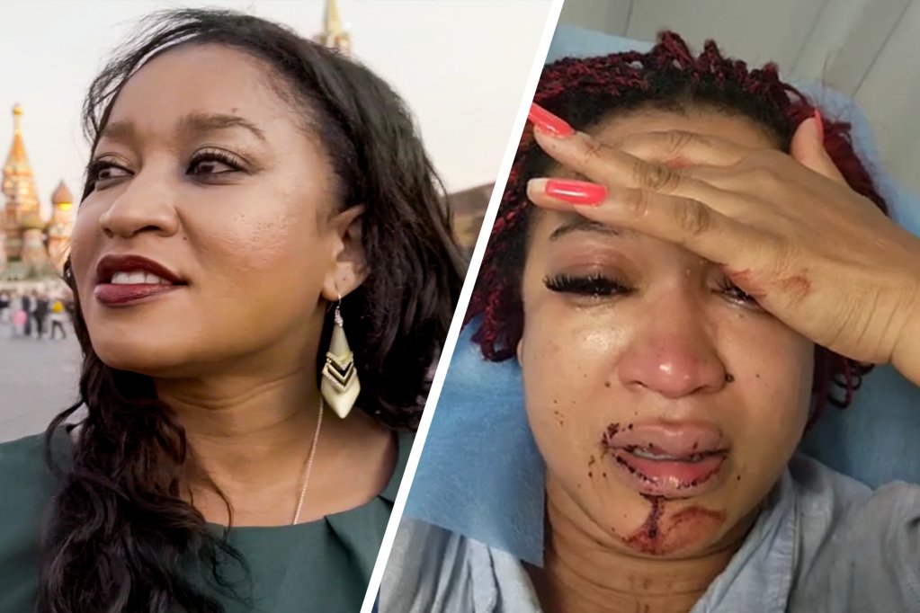 nypost's tweet image. Black woman who left US for Russia to escape ‘discrimination’ is beaten by racist neighbors trib.al/pGGgtZi