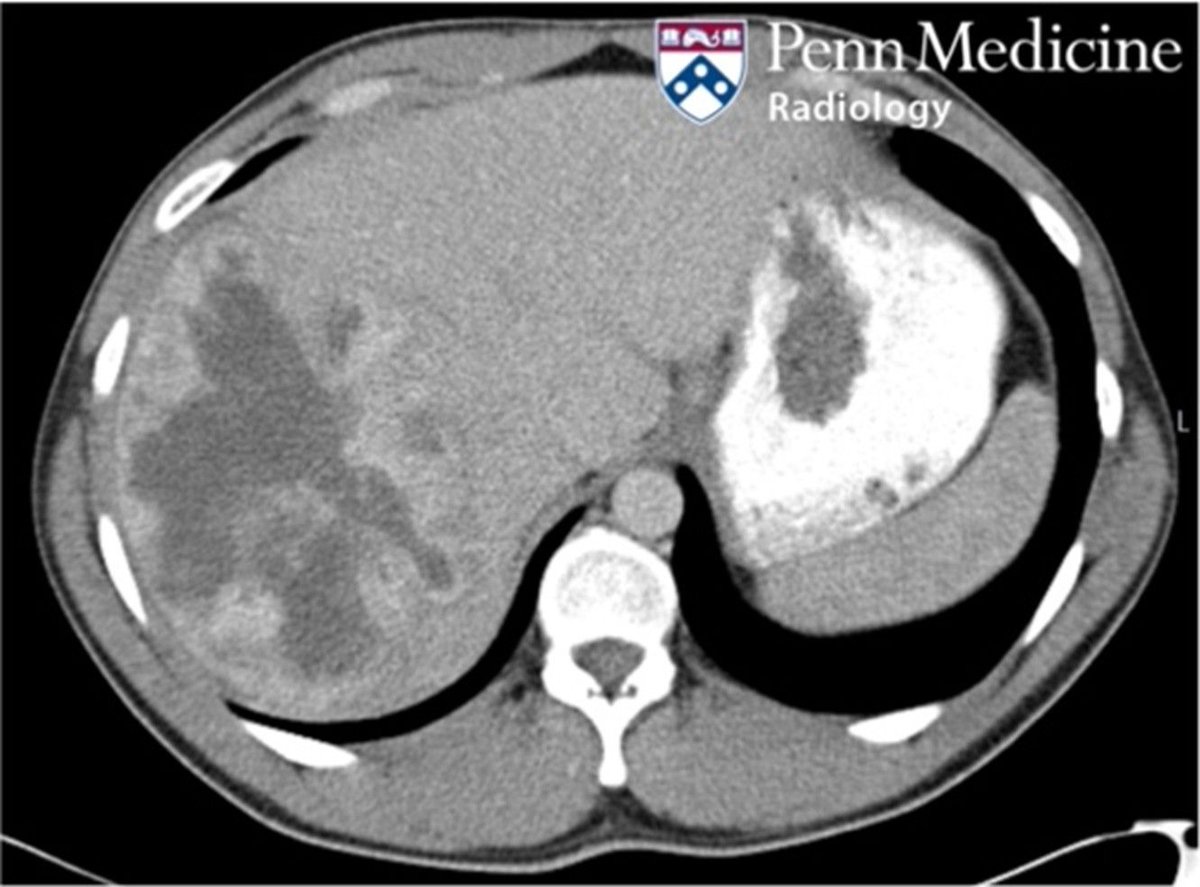 AuntMinnie's tweet image. How would you diagnose this case? #radiology @PennMedicine buff.ly/JQKAz2O