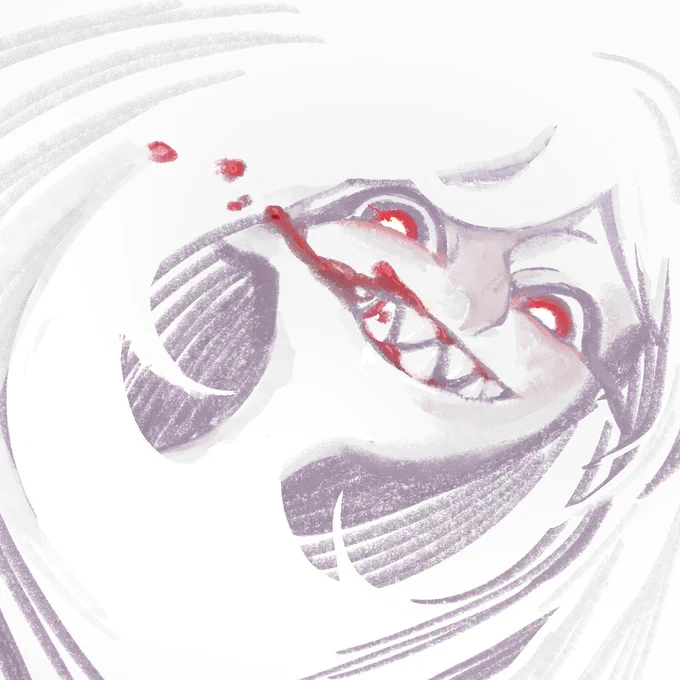gingivitis