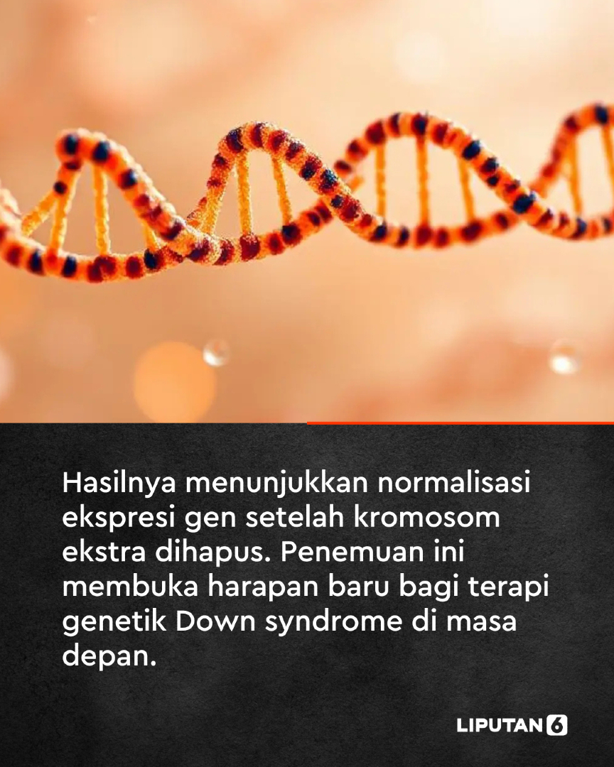 liputan6dotcom's tweet photo. Penelitian baru dari Universitas Mie, Jepang menunjukkan bahwa dengan menggunakan teknologi modifikasi DNA yang disebut CRISPR, kelebihan kromosom terkait Down Syndrome dapat dihilangkan.
#liputan6dotcom #lip6van #popartlip6 #berita https://t.co/TaQsUKFkbi