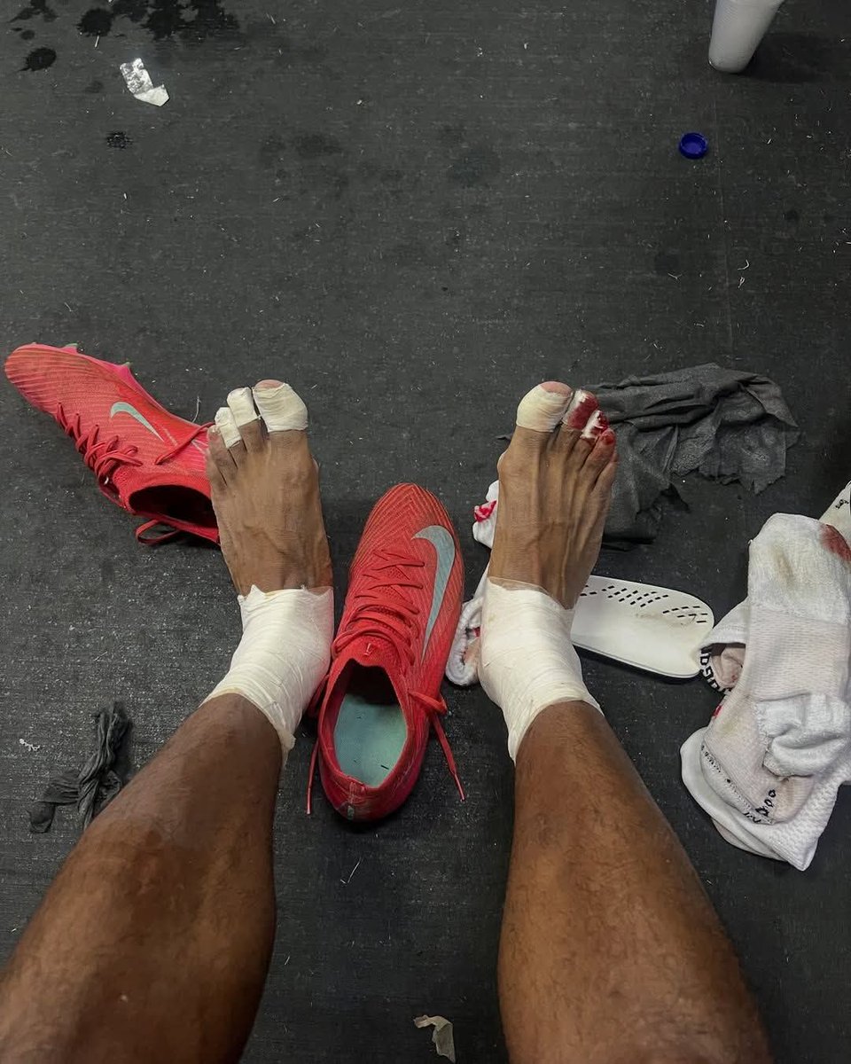 Los pies de nuestro señor Jesucristo después de estar 40 dias en el desierto