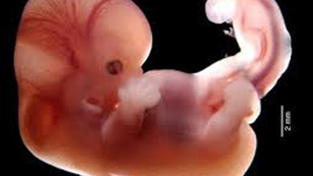 EQueimada's tweet image. El sistema nervioso, tanto central (cerebro y médula espinal) como periférico (nervios que recorren el cuerpo), es el encargado de transmitir y procesar las señales de dolor.
El desarrollo del sistema nervioso del feto comienza muy temprano en el embarazo, específicamente con la…