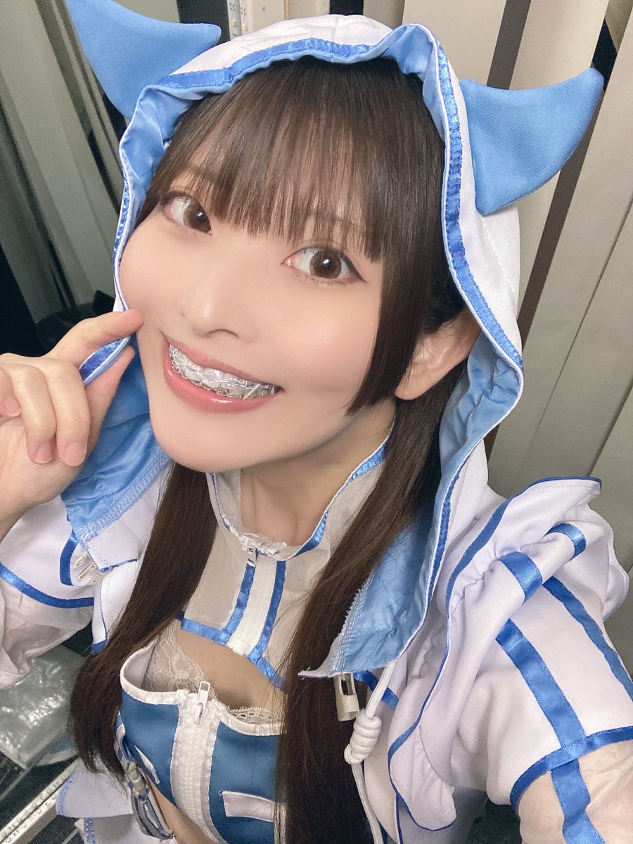 ⚠裁断済み　補綴と矯正 外科及び矯正治療の複合症例報告 | 所沢市小手指 関歯科/矯正