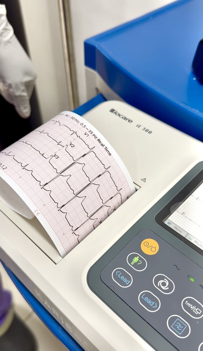 andykristian's tweet image. I just did an ECG at @KarisMedical. To be honest, since the Covid shots — especially mRNA ones, been concerned about my heart health. Relieved to find that my heart is normal. First time ever to do an ECG. If i’d found issues, I would need a cardiologist. Come check your heart!