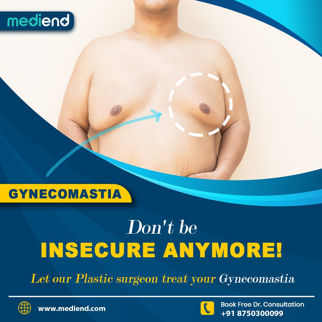 KundkundGroup's tweet photo. Regain a flatter, more masculine chest with expert #gynecomastiasurgery at #mediENDSurgeryCare. Achieve lasting results with safe, scar-minimizing techniques and personalized care that boosts confidence. 
.
#MaleChestReduction #BodyConfidence  #PlasticSurgery https://t.co/YcCJ109jzb