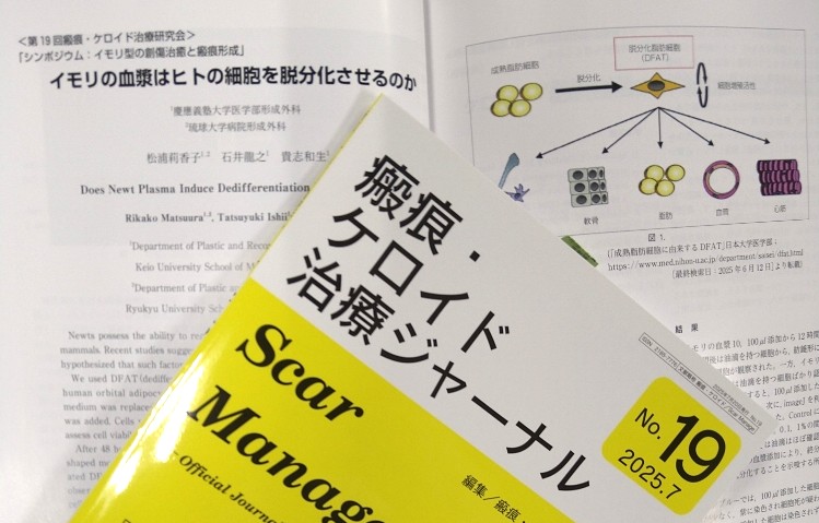 瘢痕・ケロイド治療ジャーナル Ｎｏ．２　２００８．３/全日本病院出版会/瘢痕・ケロイド治療研究会（単行本） 瘢痕・ケロイド治療ジャーナル No．2 2008．3/全日本