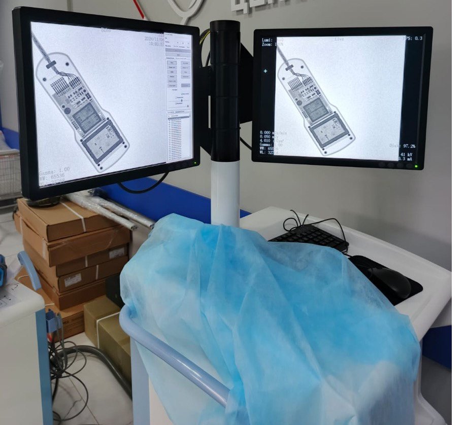 PerloveMedical's tweet photo. π¨ New Installation Alert!
Perloveβs PLX118F Mobile C-arm has been successfully installed at Odintsovo Regional Hospital, Russia π·πΊ!
Real imaging β
On-site training β
Clinical ready β
Proud to support precision care in the Moscow region!
#PLX118F #CarmXray #Perlove #Russia https://t.co/wvqcBg8xTd