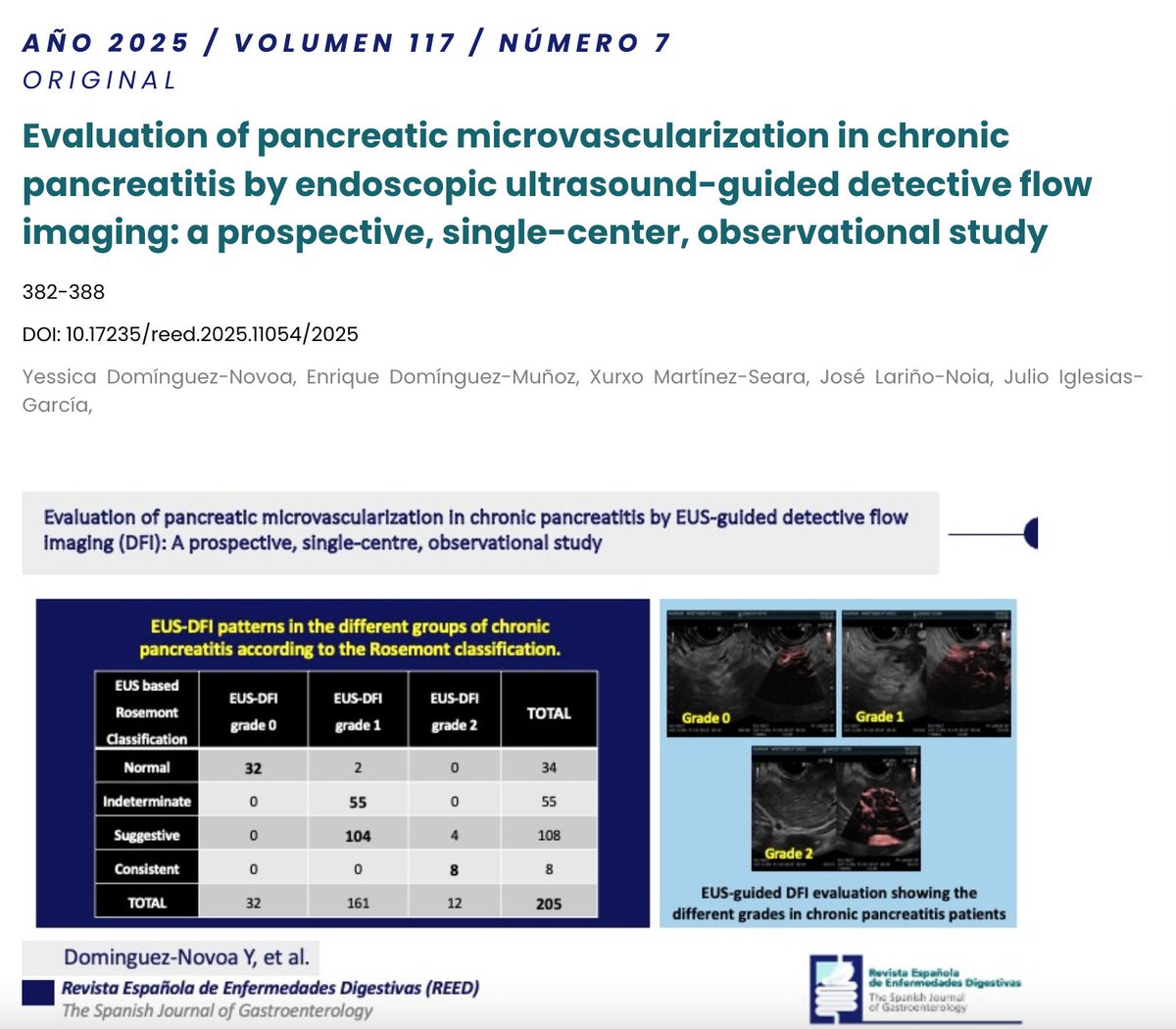 Sociedad Española de Patología Digestiva (SEPD) (@sepdigestiva) on Twitter photo Original | <a href="/REEDigestivas_/">Revista Española Enfermedades Digestivas(REED)</a>
📖 Evaluation of pancreatic microvascularization in chronic pancreatitis by endoscopic ultrasound-guided detective flow imaging: a prospective, single-center, observational study
🔗 reed.es/evaluation-of-…
<a href="/Ydomingueznovoa/">Yessica Dominguez Novoa</a> <a href="/EDominguezMunoz/">J. Enrique Dominguez-Munoz</a> Original | <a href="/REEDigestivas_/">Revista Española Enfermedades Digestivas(REED)</a>
📖 Evaluation of pancreatic microvascularization in chronic pancreatitis by endoscopic ultrasound-guided detective flow imaging: a prospective, single-center, observational study
🔗 reed.es/evaluation-of-…
<a href="/Ydomingueznovoa/">Yessica Dominguez Novoa</a> <a href="/EDominguezMunoz/">J. Enrique Dominguez-Munoz</a>