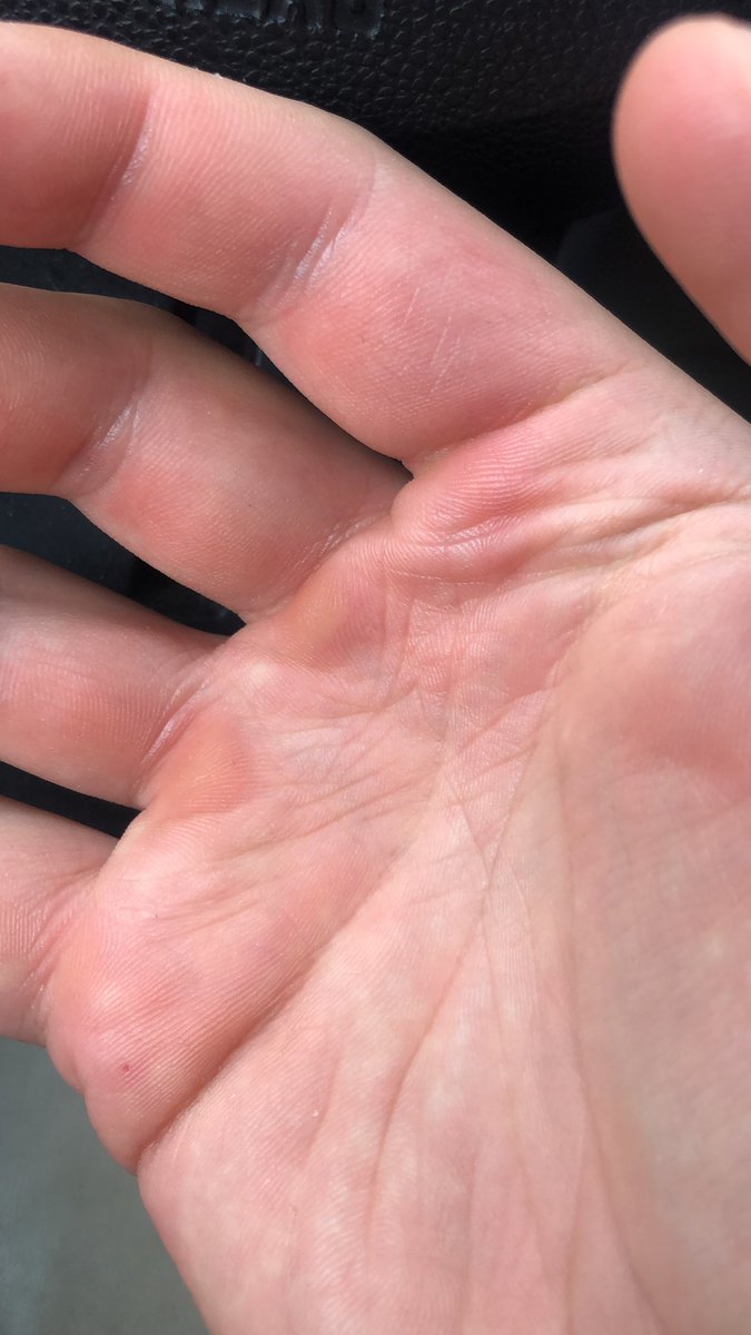 Richtig und du nicht.