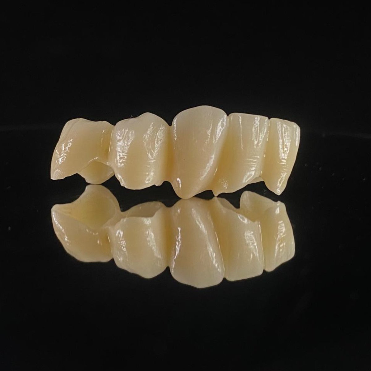 TheLabProtesis's tweet image. Un par de puentes en circonio, terminados y listos para cambiarle la sonrisa a alguien!