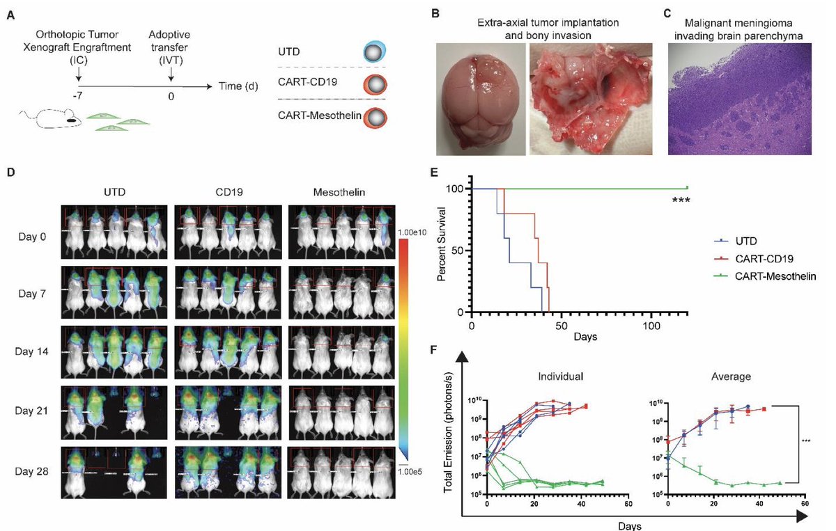 BryanDChoi's tweet image. Congrats @rishabrama and collaborators @MGBneurosurgery on our work developing Meso-CAR T cells for refractory meningiomas, published this week @NeuroOnc!
doi.org/10.1093/neuonc…