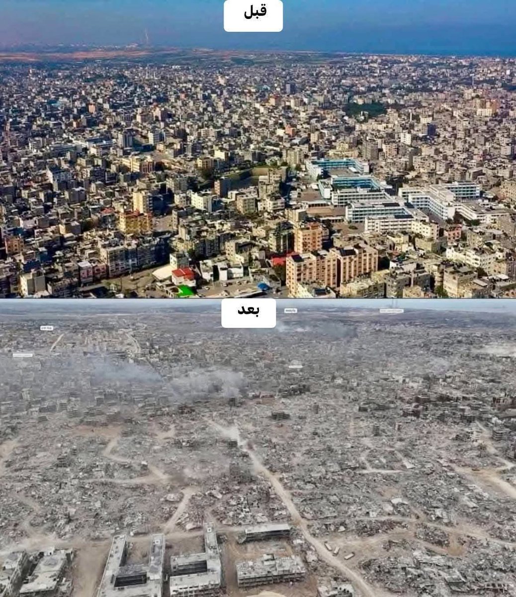 Gaza before and after 💔🥲
