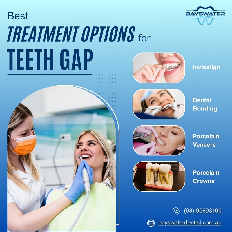 bayswaterdentst's tweet image. 🦷 Mind the gap? Fix it with confidence!

Discover the best treatment options for teeth gaps👇

✅ Invisalign
✅ Dental Bonding
✅ Porcelain Veneers
✅ Porcelain Crowns
📞 (03)-90693100

🌐 bayswaterdentist.com.au
#TeethGap #SmileMakeover #Invisalign #DentalCare #BayswaterDentist