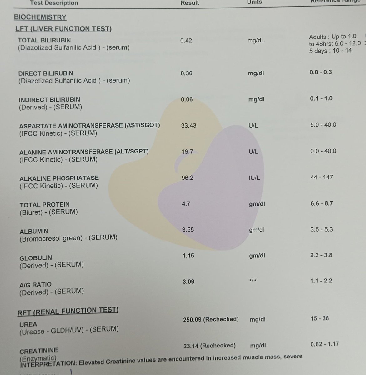 Dr Ganesh Srinivasa Prasad (@thisis_drgsp) on Twitter photo While abby is mocking <a href="/viditchess/">Vidit Gujrathi</a> family.. somewhere in TN this patient is not ready to accept his kidneys have permanently failed & trying ayurveda since 1 yr
Last year I told him u need transplant..he didn't listen, now came in a near dying situation
After dialysis he improved While abby is mocking <a href="/viditchess/">Vidit Gujrathi</a> family.. somewhere in TN this patient is not ready to accept his kidneys have permanently failed & trying ayurveda since 1 yr
Last year I told him u need transplant..he didn't listen, now came in a near dying situation
After dialysis he improved