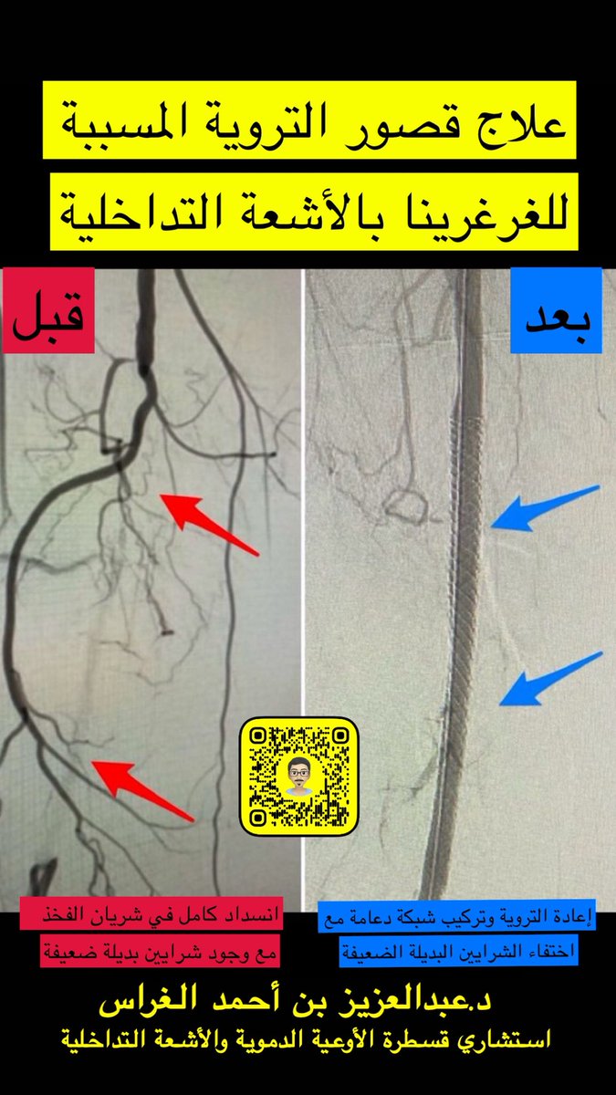 Abdulaziz AlGharras عبدالعزيز أحمد الغراس tweet media