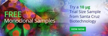 SantaCruzBio's tweet image. Need #free antibody samples?!  Contact us and learn how to receive free samples!!! Everyone love samples😍📷 #samples #biotech #BindingProteins #Research