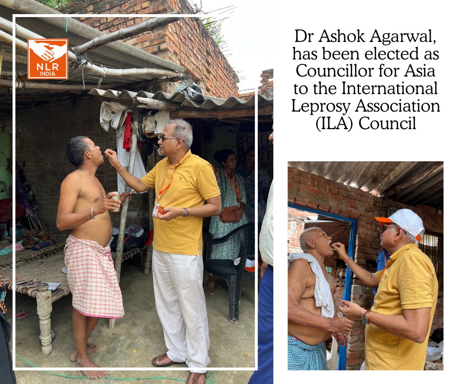 We are proud to share that our CEO, Dr Ashok Agarwal, has been elected as Councillor for Asia to the International Leprosy Association (ILA) Council.
This remarkable achievement is a true recognition of his unwavering dedication to the cause of leprosy elimination.