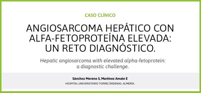⚠️ No toda elevación de alfa-fetoproteína significa hepatocarcinoma. También puede verse en tumores como el angiosarcoma hepático, un reto diagnóstico si no se sospecha a tiempo 🩸🧬 #Hígado #Oncología

👉:sapd.es/rapd/2025/48/3…