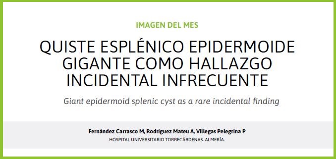 Los quistes esplénicos epidermoides son lesiones benignas y poco frecuentes, de origen congénito ⚠️ Su diagnóstico puede confundirse con tumores malignos. Caso detectado incidentalmente tras cólico biliar 🏥

👉:sapd.es/rapd/2025/48/3…