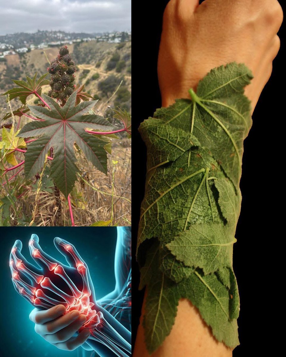 The Miraculous Benefits of Castor Leaves for Arthritis Pain
Did you know that castor leaves work wonders in the treatment of arthritis pain? Here's everything you need to know about why it works, how to use it, its benefits, and recommended doses.

Why It Works:
Castor leaves
