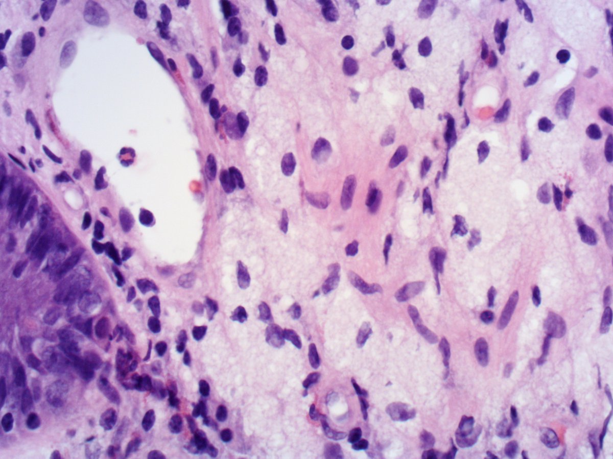 Tim Bracey tweet media