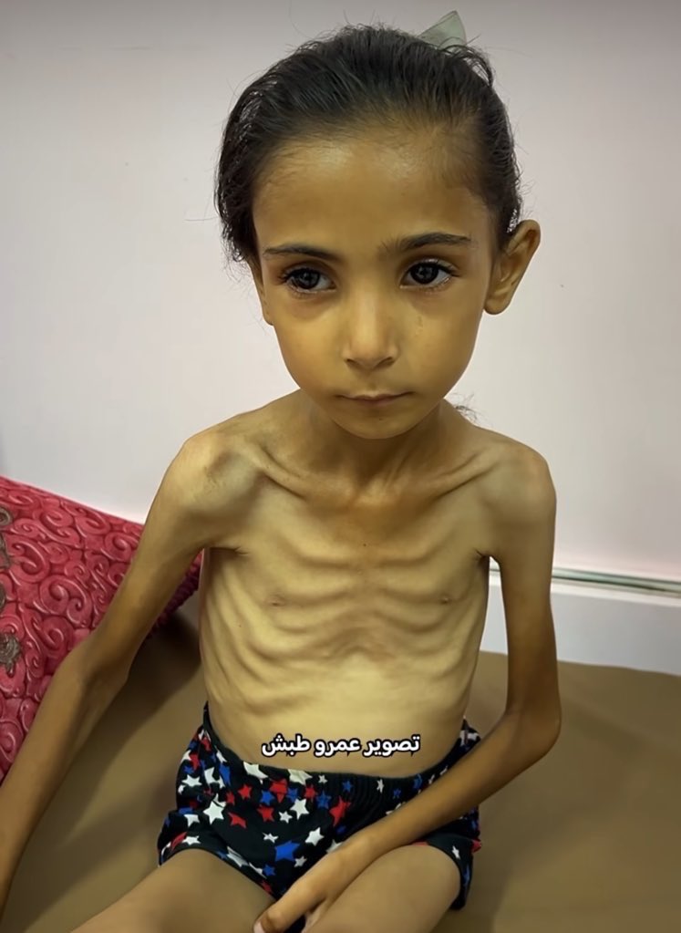 If you see this little angel girl, reply with 💔🇵🇸  

Pray for her 💔