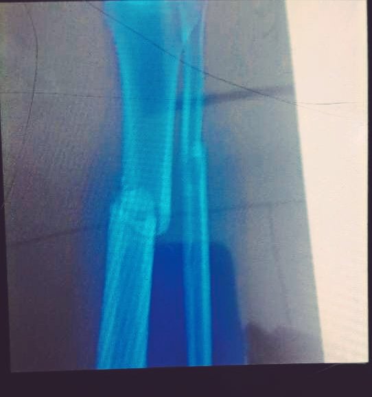 AAnouri34's tweet photo. Damn 💔 https://t.co/1DX1Ns6Rgu