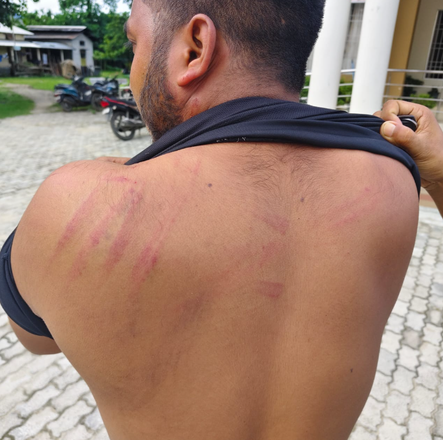 INCAssam's tweet photo. Assault on journalist Madhurya Saikia, allegedly by BJP backed goons is barbaric and alarming.

Will the BJP govt act as swiftly as it did against Congress workers accused of throwing a plastic bottle?