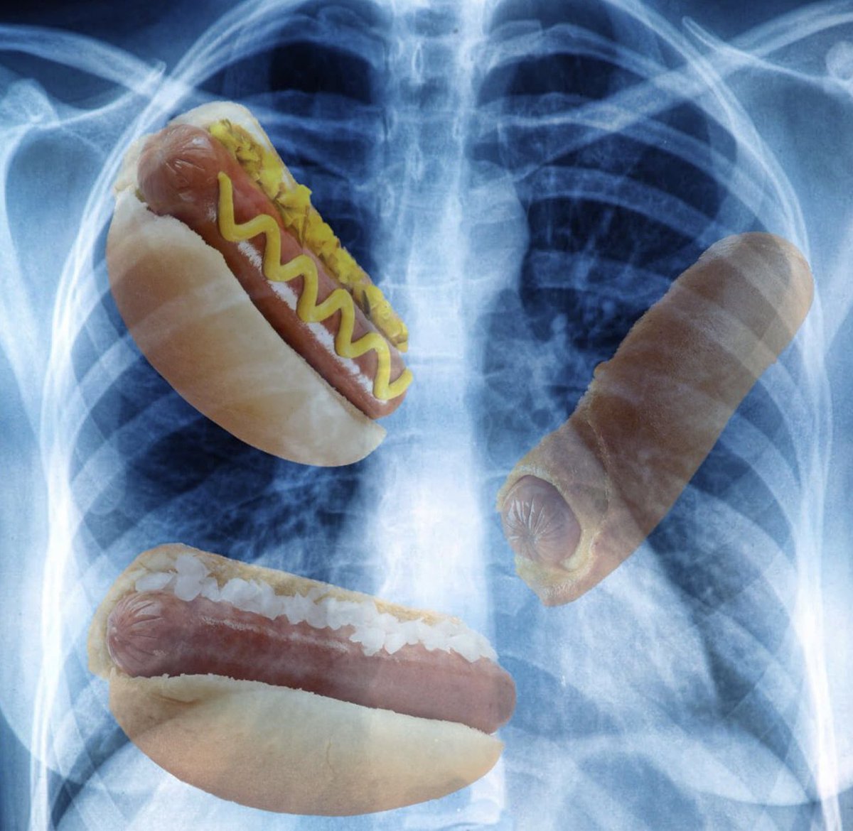 Joey Chestnut got them dogs in him