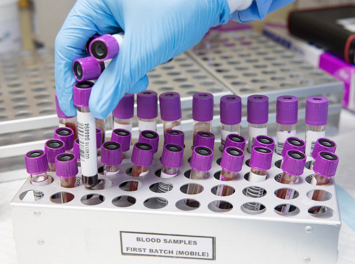 Immune_News's tweet image. 🔎 Scientists at @BIDMChealth investigated how CD39-AS affects the function of #Tregs and Th17 cells in healthy subjects and inflammatory bowel disease patients.
🔗 go.nature.com/3HeW3WD