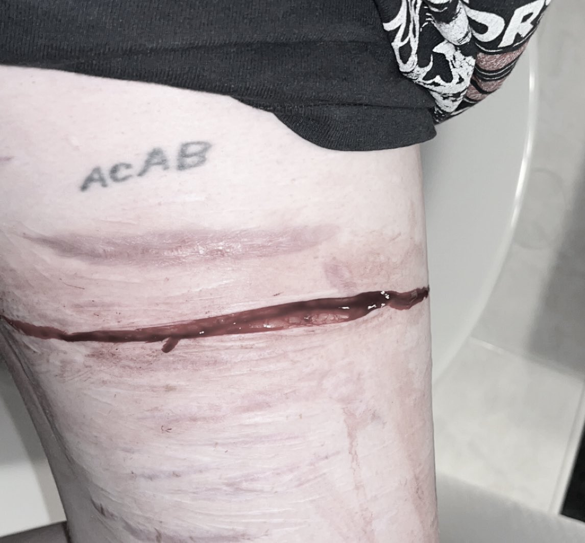 bugisbuffering's tweet photo. TW sfx, this is fake, not real! Medical purposes only! 

Meow

shtwt 988twt yellowspongetwt redlinetwt beanstwt https://t.co/iwt2gGSHi9