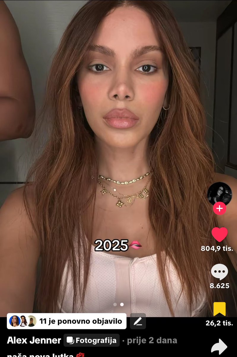 NikolaRyback's tweet image. 🚨10 million views and 800k likes in just 2 days for Anitta’s new look 🤩