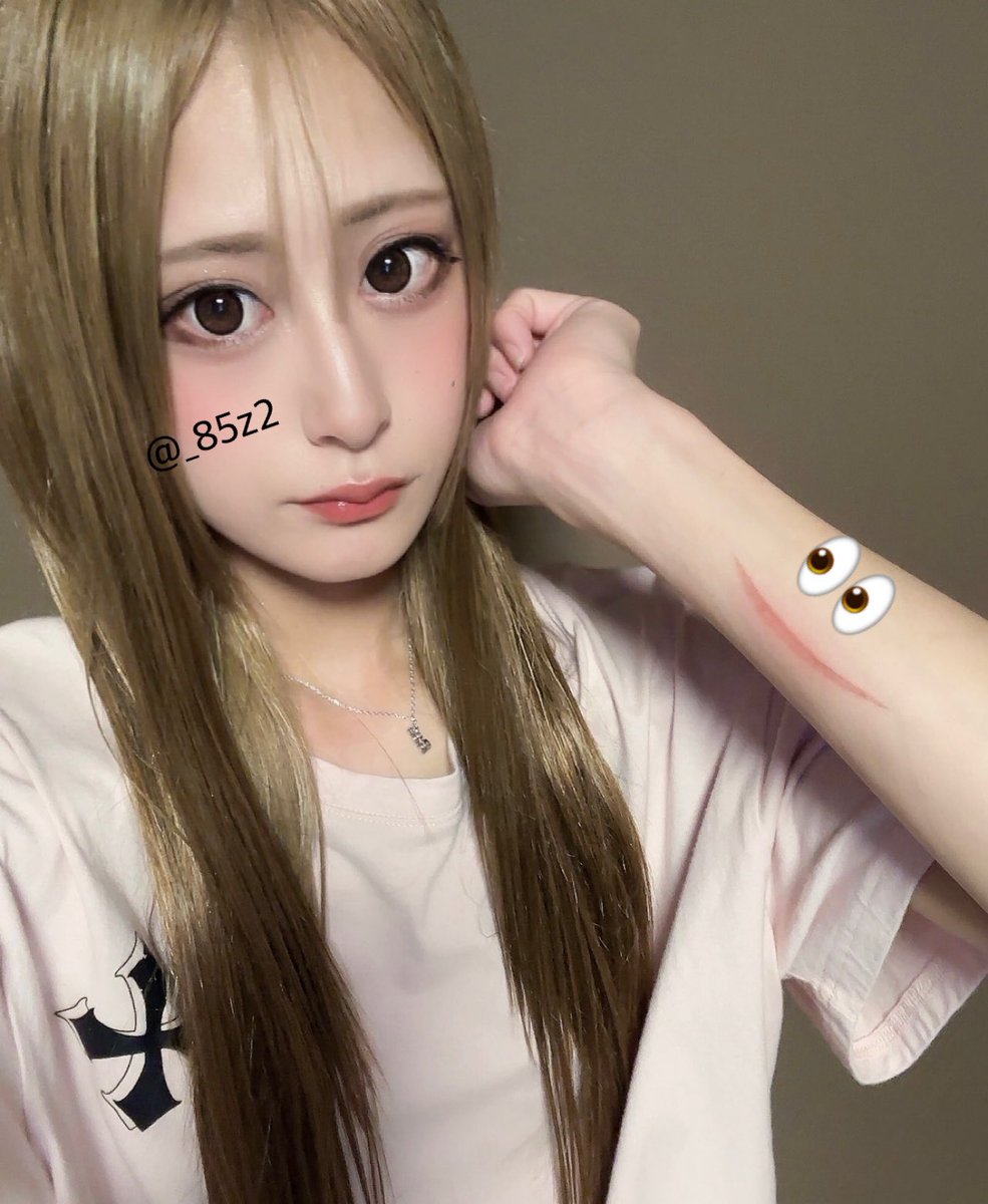 _85z2's tweet photo. 人生最後のきんぱちゅした👩🏼
にっこりの火傷 https://t.co/mvQ1qwobmA
