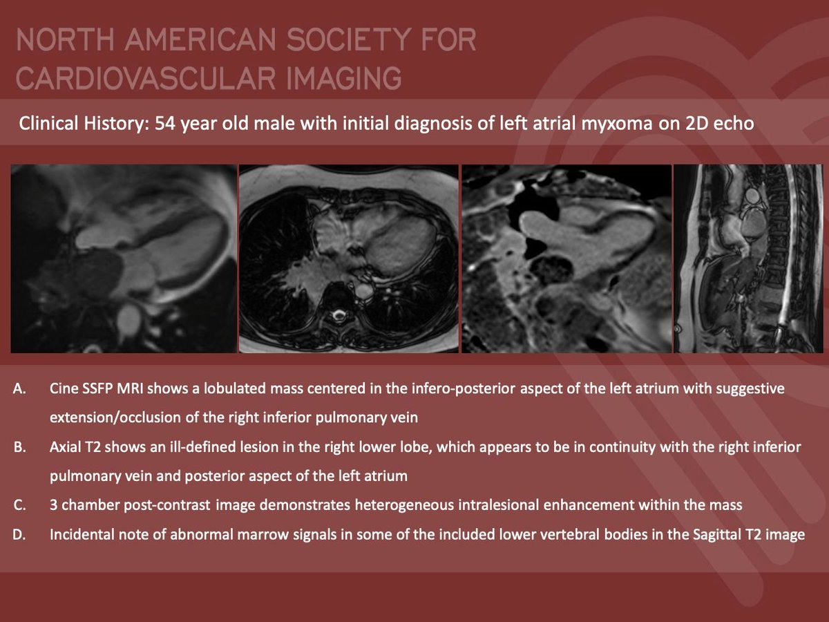 NASCISociety's tweet image. #NASCI Case Series
Case 84 Diagnosis
Courtesy of Jerald S. Lim @jgl_md from St. Luke’s Medical Center, Philippines
#whyCMR #YesCCT
@GregKicska @JRevRad1 @dianalitmano @DanielVargasMD @kirschj @prachipagarwal @AwsHamid5 @EscrOffice @CarlottaOnnis @DeCeccoCN