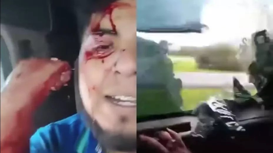Un trailero que fue víctima del crimen

Durante un intento de asalto en la México-Querétaro, el operador de la unidad recibió un disparo que lo dejó herido; tras pedir ayuda pudo ser atendido.

aztecanoticias.info/4lEmmo3