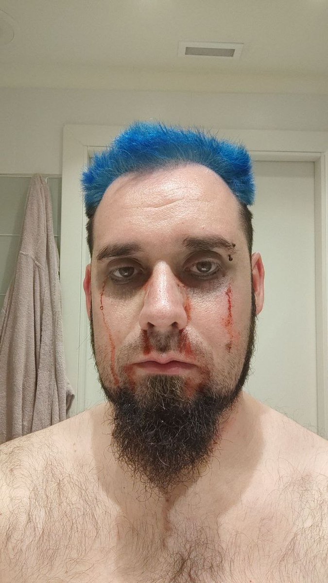 LupoXandoR's tweet photo. nice Make Up! 
#makeup #horror #Blood https://t.co/0Z2qDQTiFs