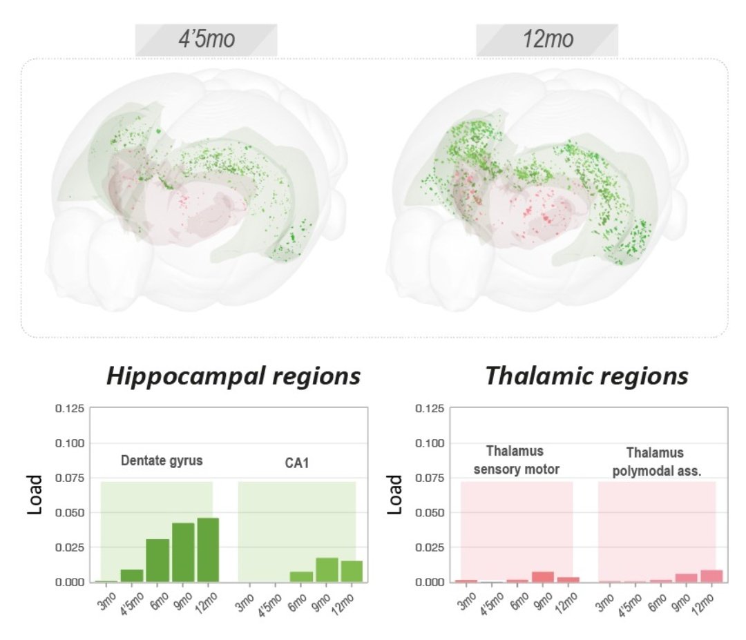 PMartinezTazo's tweet photo. Beyond happy to keep sharing my latest results! 🧠 How to bring together MRI  and histology data under the #MouseX_DW_Atlas!!  🧲 ✨
@LabMri @ISMRMIberian https://t.co/dPmdta3Kh3