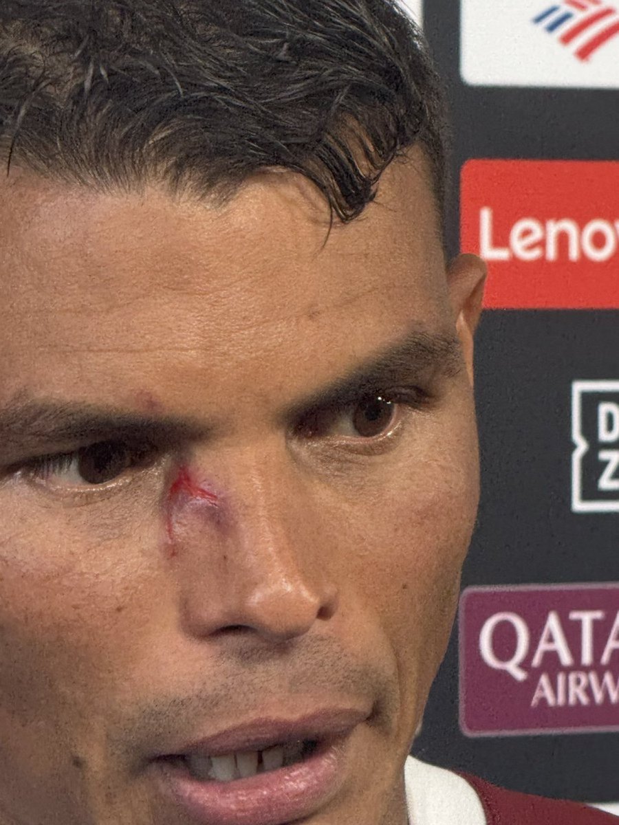 🚨🚨🚨🚨🚨🚨🚨

لاعب فلومينينسي تياغو سيلفا :

الحكم وغرفة الفار تجاهلوا طرد لاعب #الهلال الذي تعمد ايذائي، ولكن في النهاية انتصرنا على الحكم ونادي الاموال .