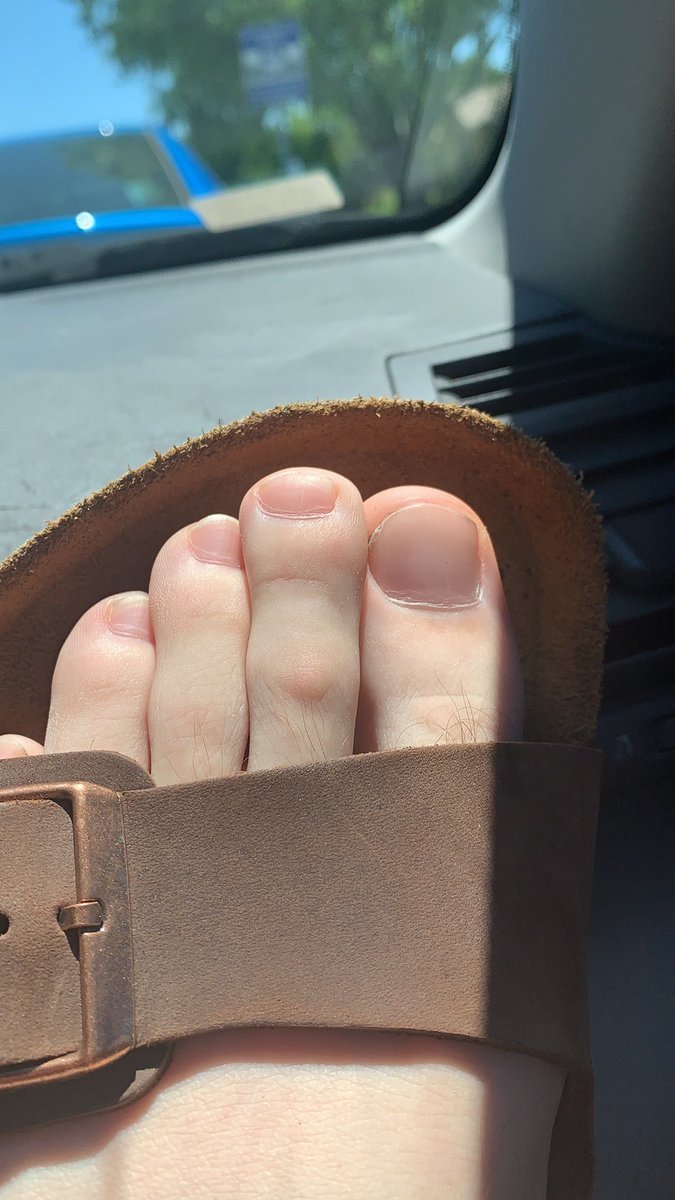 If the toe next to your big toe is longer than your big toe ur gay
