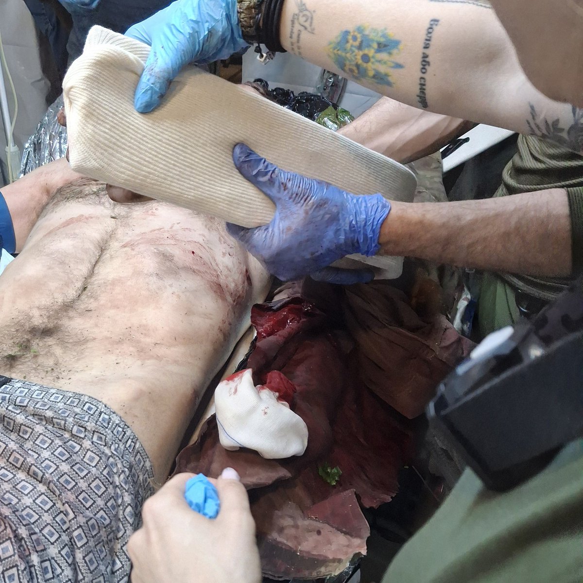 We are the stabilization point. 

We are made up of forward surgical teams (surgeons and anesthesiologits) , combat medics, and nurses working close to the front line, receiving casualties in all conditions. 

Today you will see a series of photos from the stab that show the work