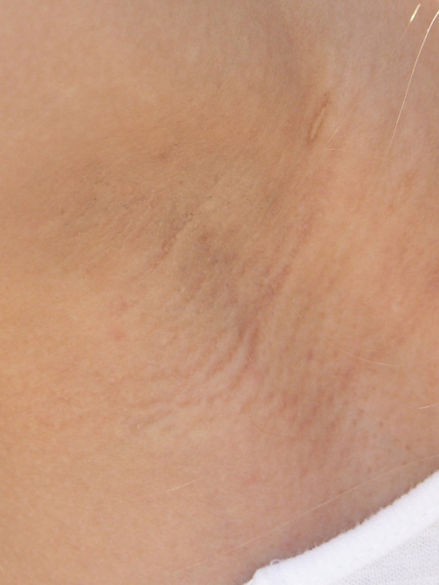 2007 wakinanpa
sexyunderarm.com