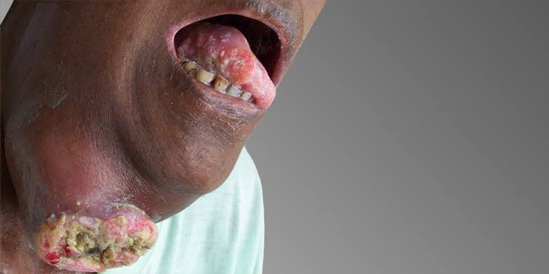 Dr Anuj Kumar (@dranuj_k) on Twitter photo आप अपने और अपने परिवार के साथ जो सबसे बुरा कर सकते हैं वो है तंबाकू का सेवन ।
तंबाकू सिर्फ आपके लिए जानलेवा नहीं है ।
तंबाकू पहले आपको और आपके परिवार को तड़पाता है और फिर आपकी जान लेता है ।
अपने परिवार के ऊपर एहसान करें ।
तंबाकू का सेवन ना करें । आप अपने और अपने परिवार के साथ जो सबसे बुरा कर सकते हैं वो है तंबाकू का सेवन ।
तंबाकू सिर्फ आपके लिए जानलेवा नहीं है ।
तंबाकू पहले आपको और आपके परिवार को तड़पाता है और फिर आपकी जान लेता है ।
अपने परिवार के ऊपर एहसान करें ।
तंबाकू का सेवन ना करें ।