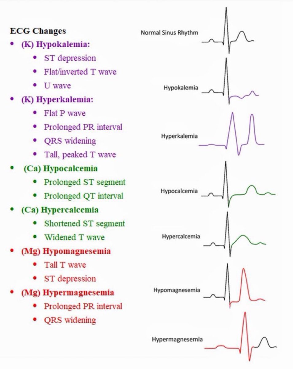 ECG changes &amp; electrolyte abnormalities (source unknown)

#MedEd #FOAMed #TipsforNewInterns