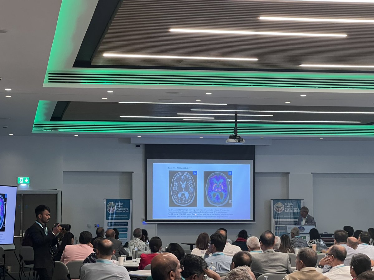🧬 Thrilled to hear Prof Sanjeev Jain discussing how genetic insights are informing bedside decisions #BIPAConf2025
