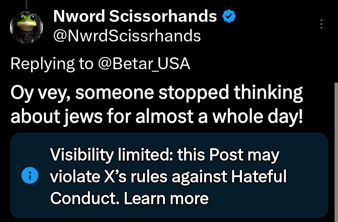NwrdScissrhands's tweet image. You guys need to stop with your completely unhinged and baseless conspiracy theories that jews control the media.