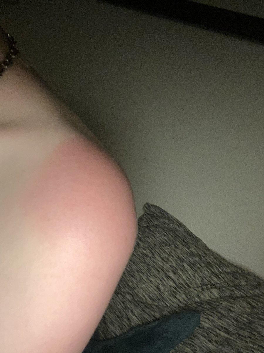 puppycarousel's tweet image. Who the fuck decided that the sun should ion beam skin