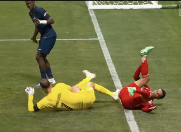 Musiala just broke his leg 🦵😭😭💔💔 Get well soon Musiala! 
#BayernMunich #PSG